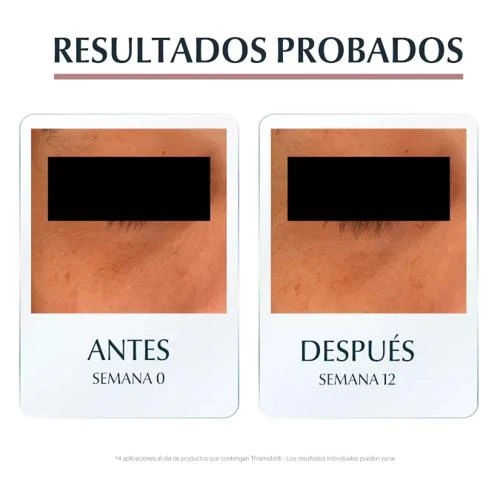 Eucerin Anti-Pigment Contorno De Ojos 15 Ml 9 Eucerin Anti-Pigment Contorno De Ojos 15 Ml - Imagen 7