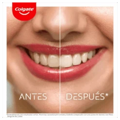 Colgate® Pasta De Dientes Colgate Max White Overnight Pincel Blanqueador 2,5ml 19 Colgate® Pasta De Dientes Colgate Max White Overnight Pincel Blanqueador 2,5ml -Personal Cuidado Productos Tienda Pasta de dientes Colgate Max White Overnight pincel blanqueador 2 5ml 6