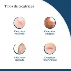 Trofolastin Reductor Cicatrices 5x7,5cm 5 Uds 19 Trofolastin Reductor Cicatrices 5x7,5cm 5 Uds -Personal Cuidado Productos Tienda Trofolastin Reductor Cicatrices 5x7 5cm 5 uds 3